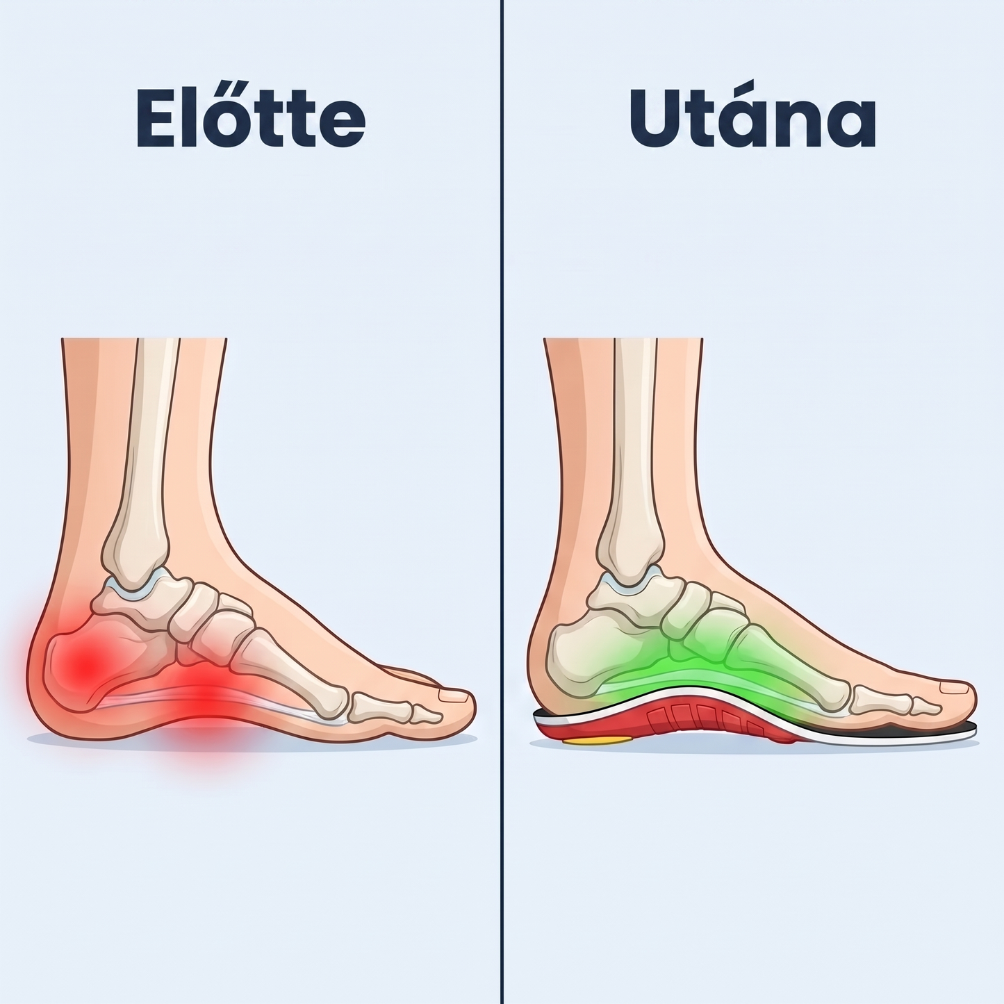 ArcoFlex™ Ortopédiai támasztó talpbetétek