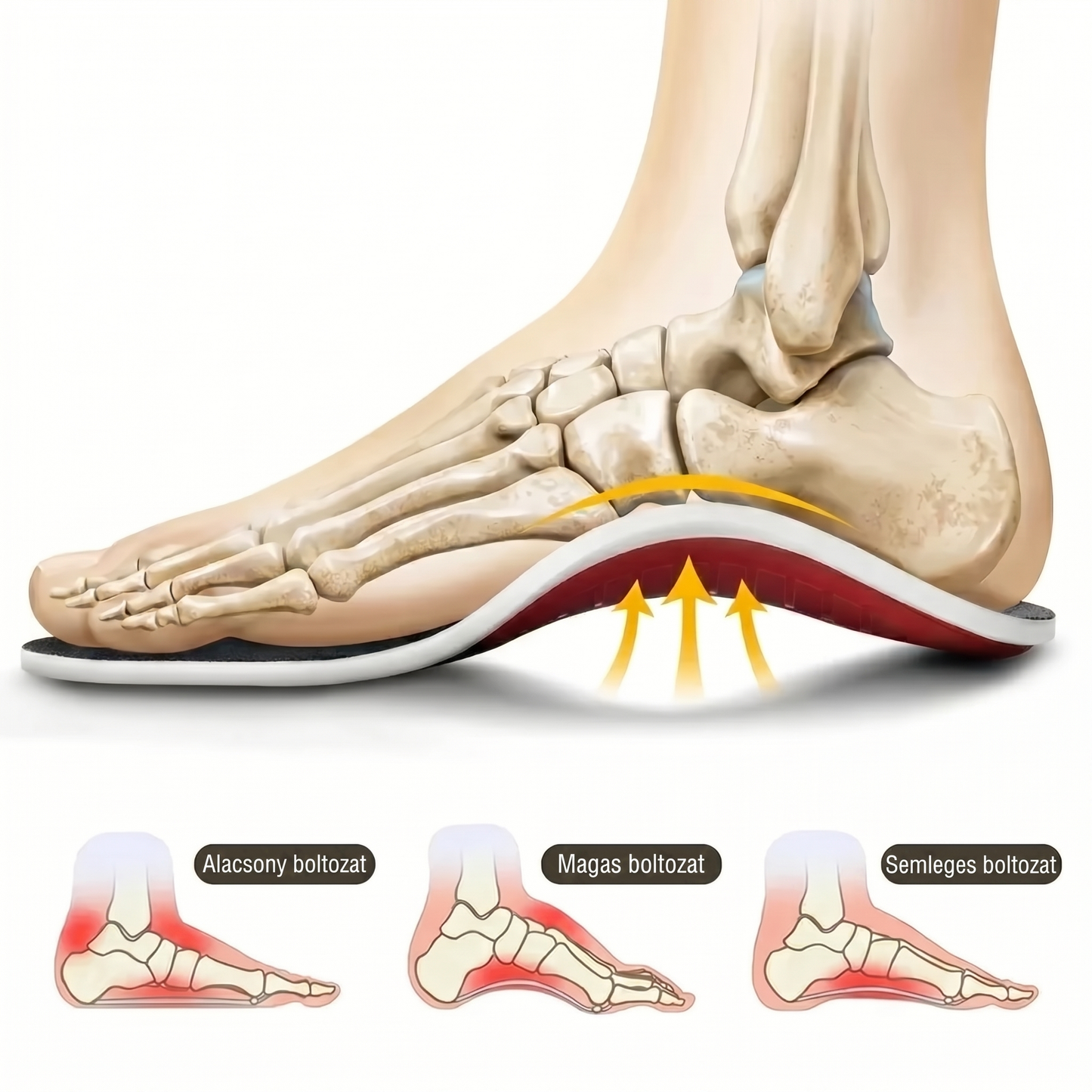 ArcoFlex™ Ortopédiai támasztó talpbetétek